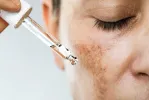 PANORAMA DERMO | Sérum Clareador, tratamento e proteção para todos os tipos de pele